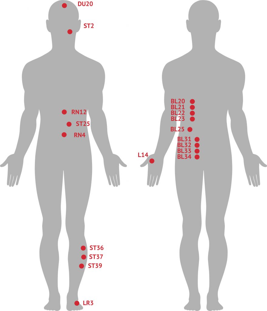 Acupoints for DGBI